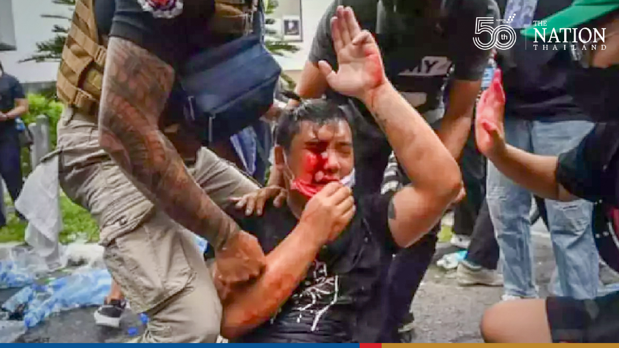 Family vows legal action after activist blinded in one eye by alleged police action