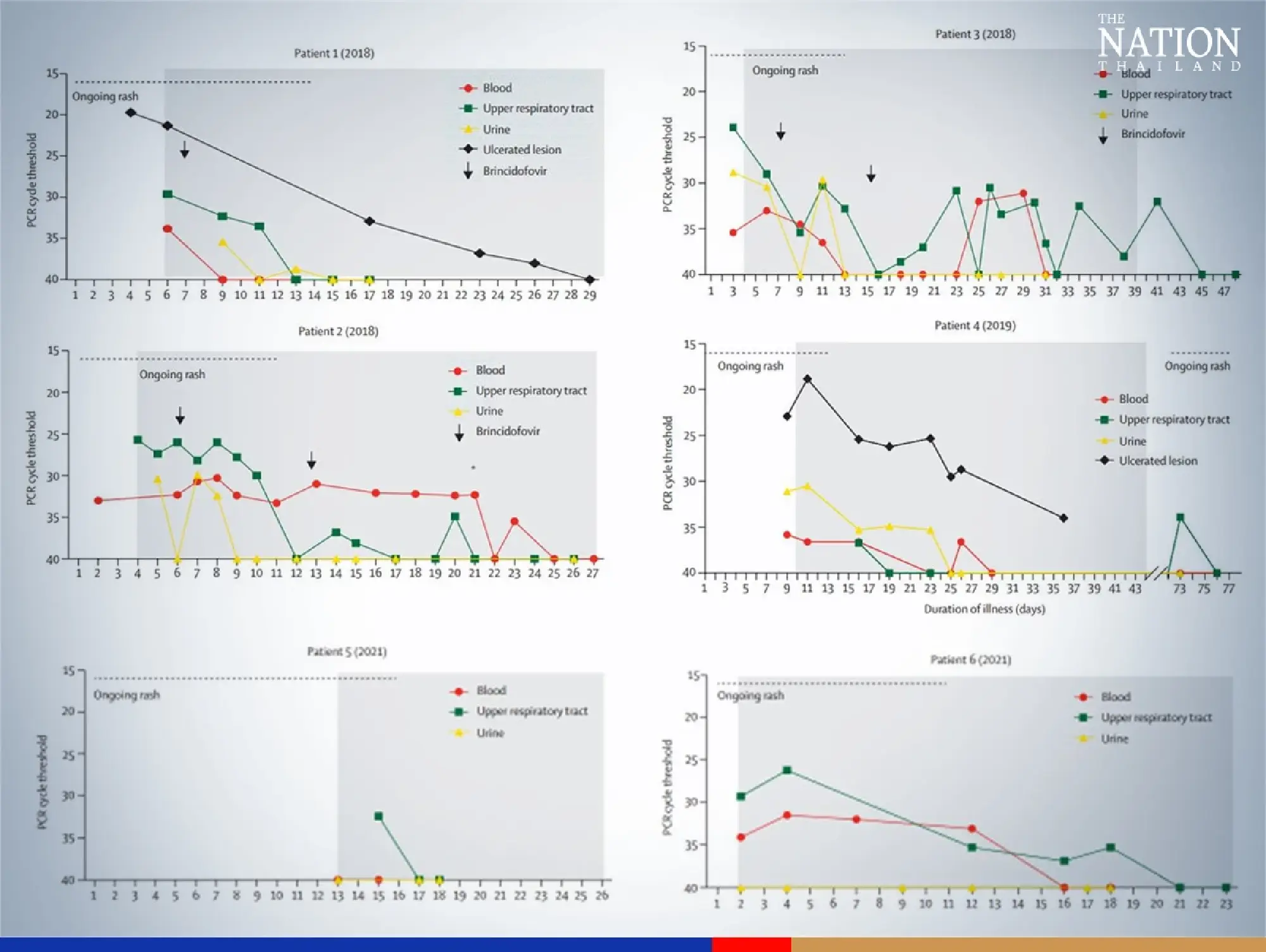Virologist offers advice on keeping monkeypox at bay