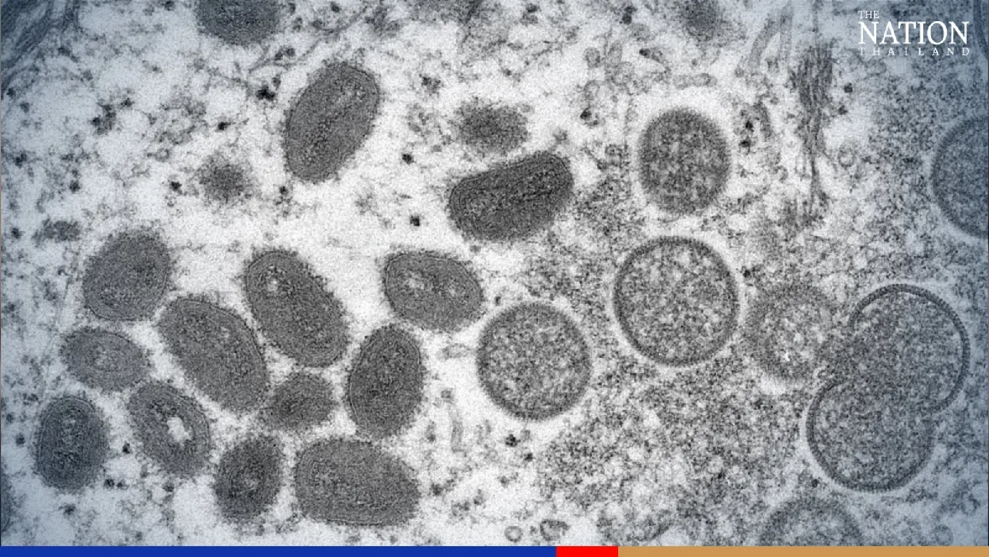 16 people in contact with Thailand’s 2nd monkeypox case test negative