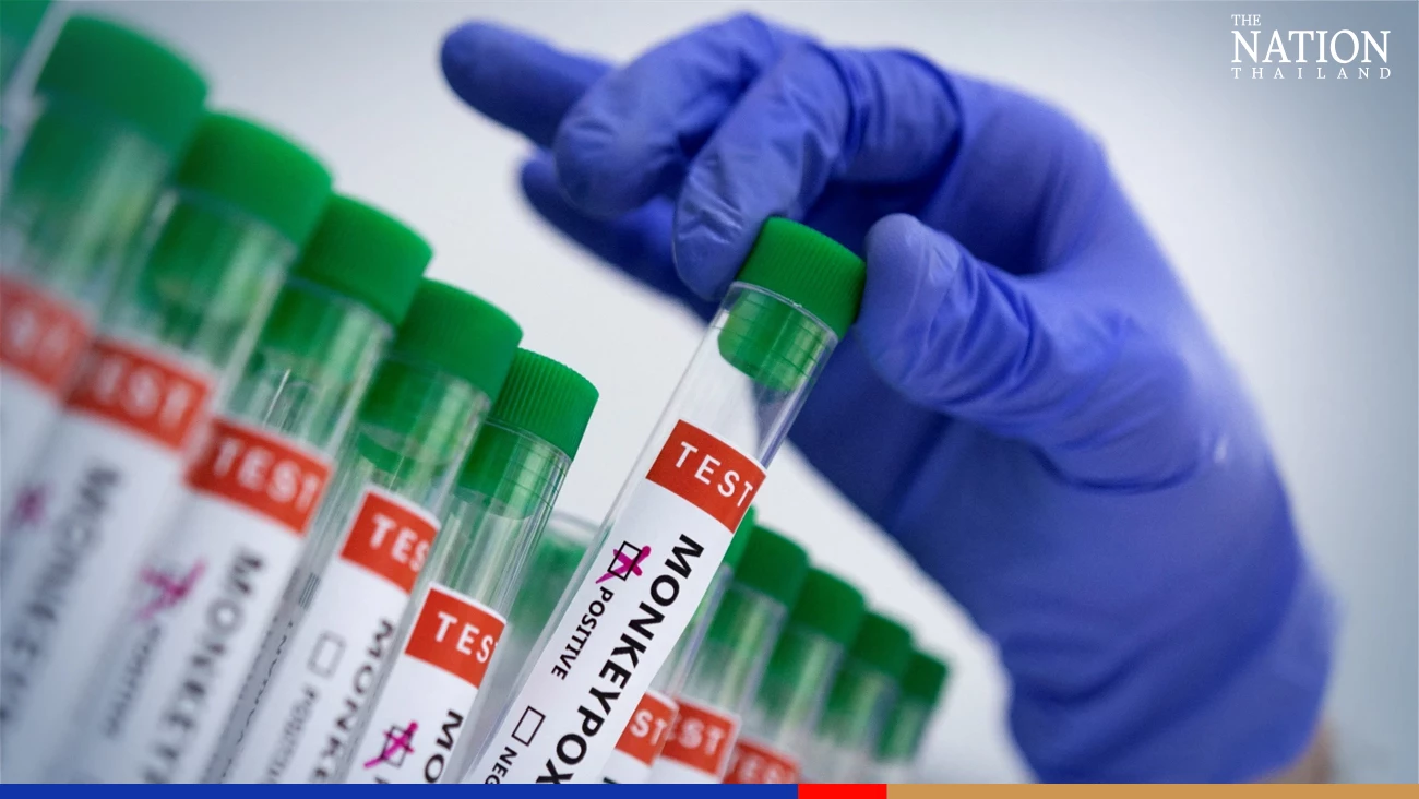 Phuket tourist and service worker test positive for monkeypox