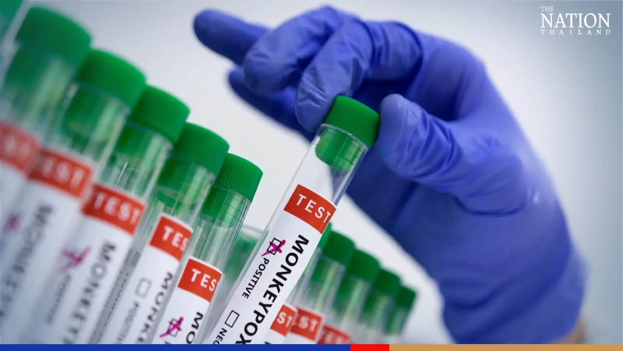 Phuket tourist and service worker test positive for monkeypox