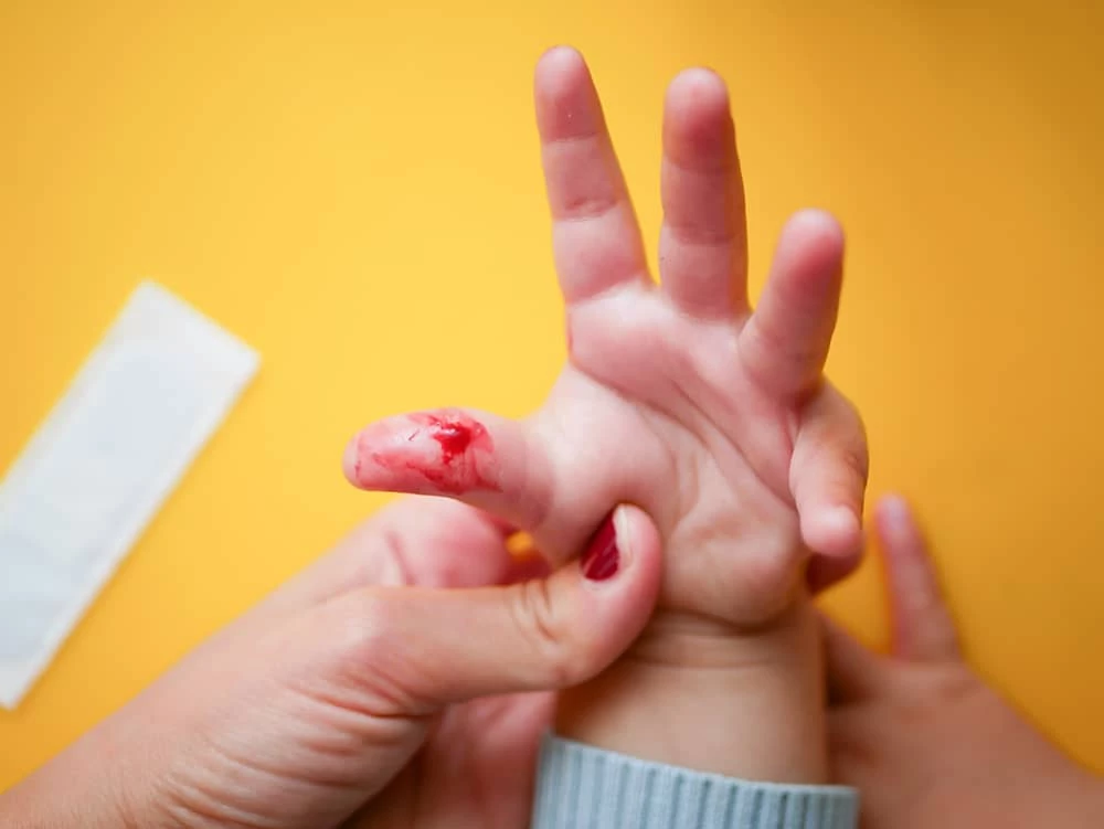 “Haemophilia” – a Disease that May Not Be Cured But Opportunities for  a Good Life Are Still Possible