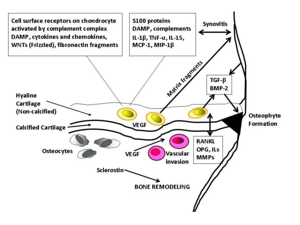 Chula Medicine Determines “Cytokines” as Indicator of “Degenerative Joints” 