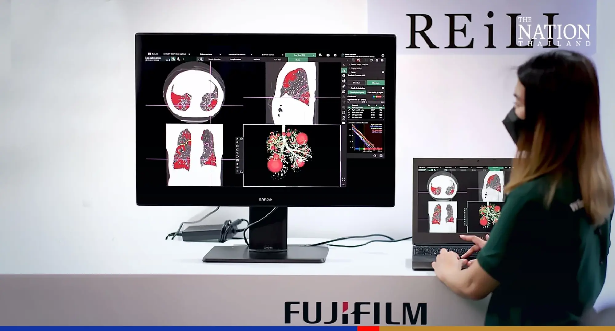 REiLI; medical AI technology.