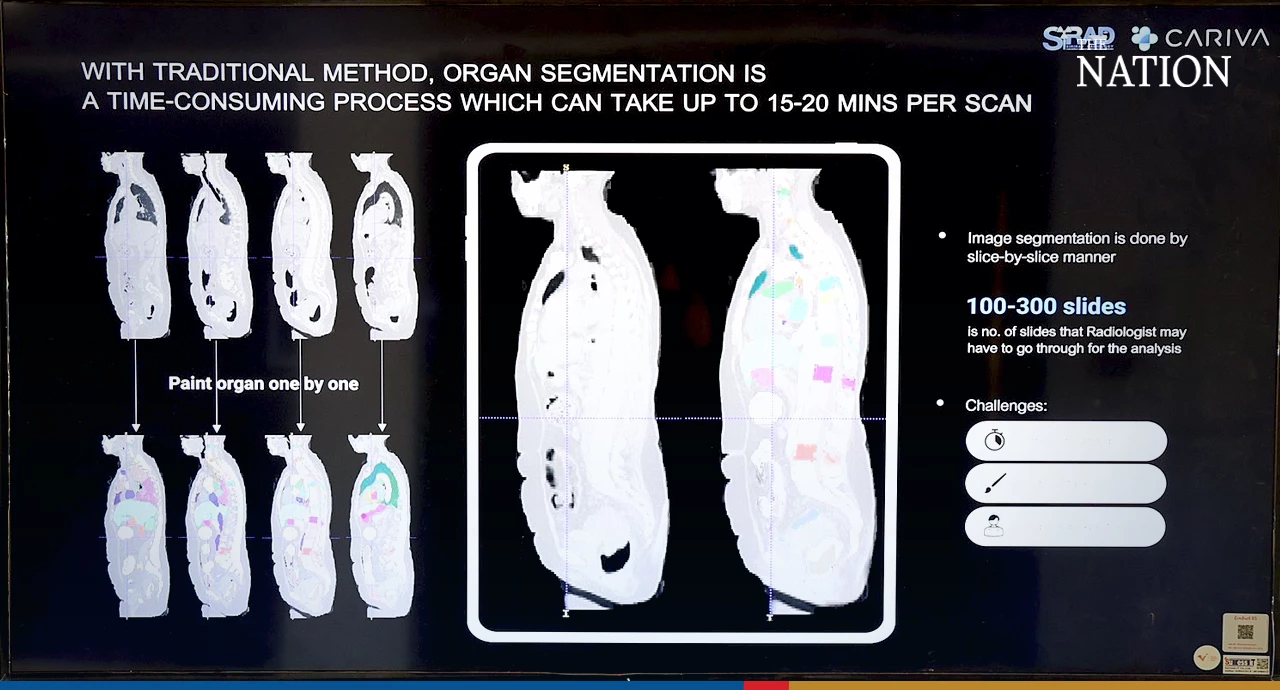 Siriraj Hospital ties up with CARIVA for new medical breakthroughs