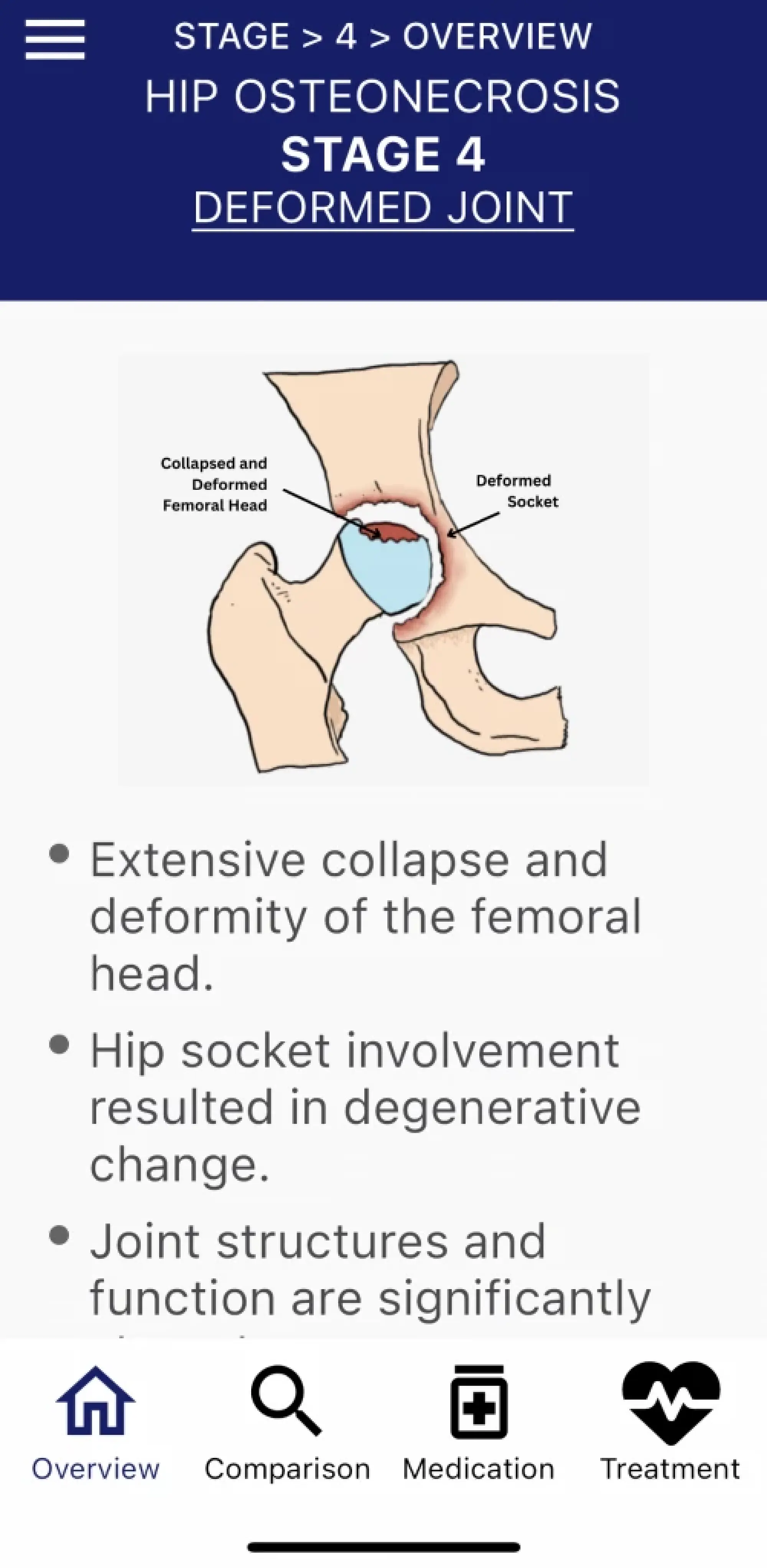 New Thai app empowers orthopaedic patients with knowledge and support