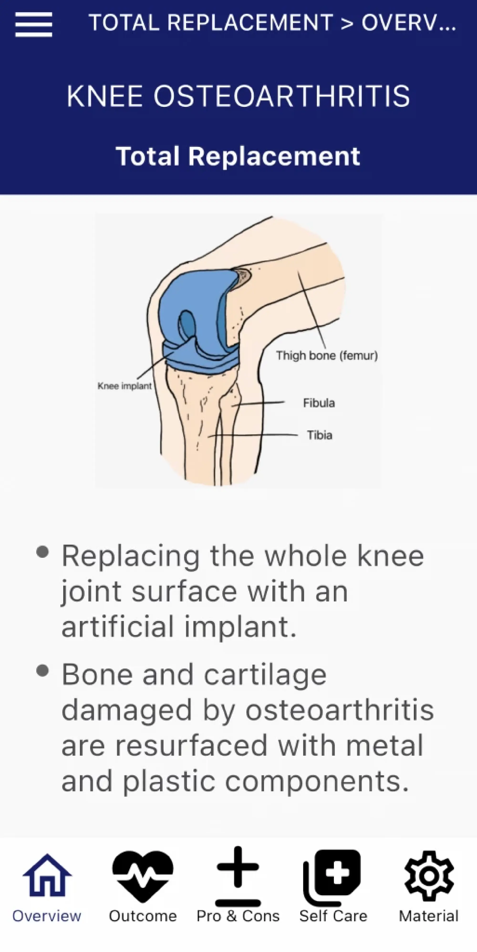 New Thai app empowers orthopaedic patients with knowledge and support