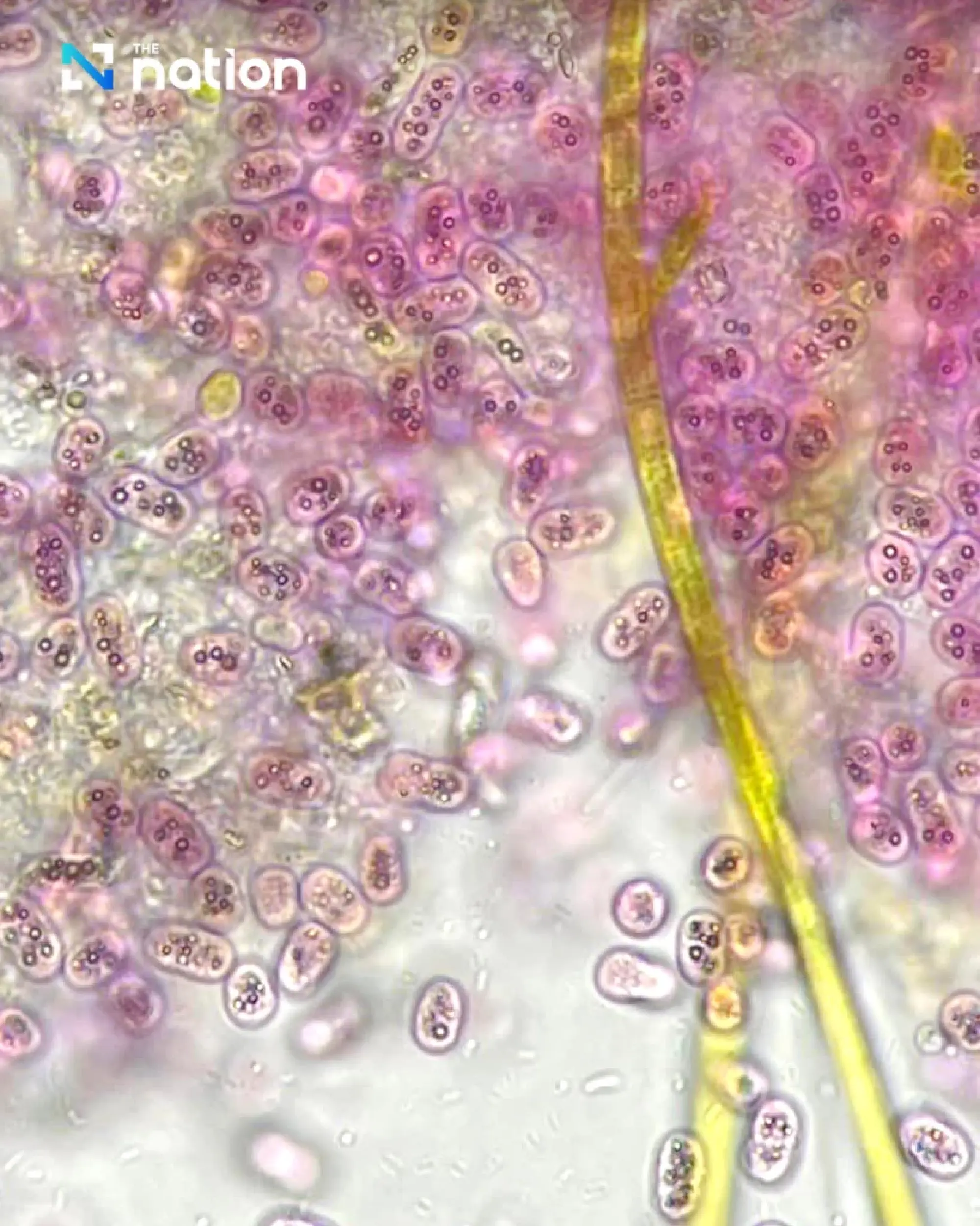 Germs in stagnant water likely cause of pink shade of Nonthaburi canal on Valentine’s day, say scientists