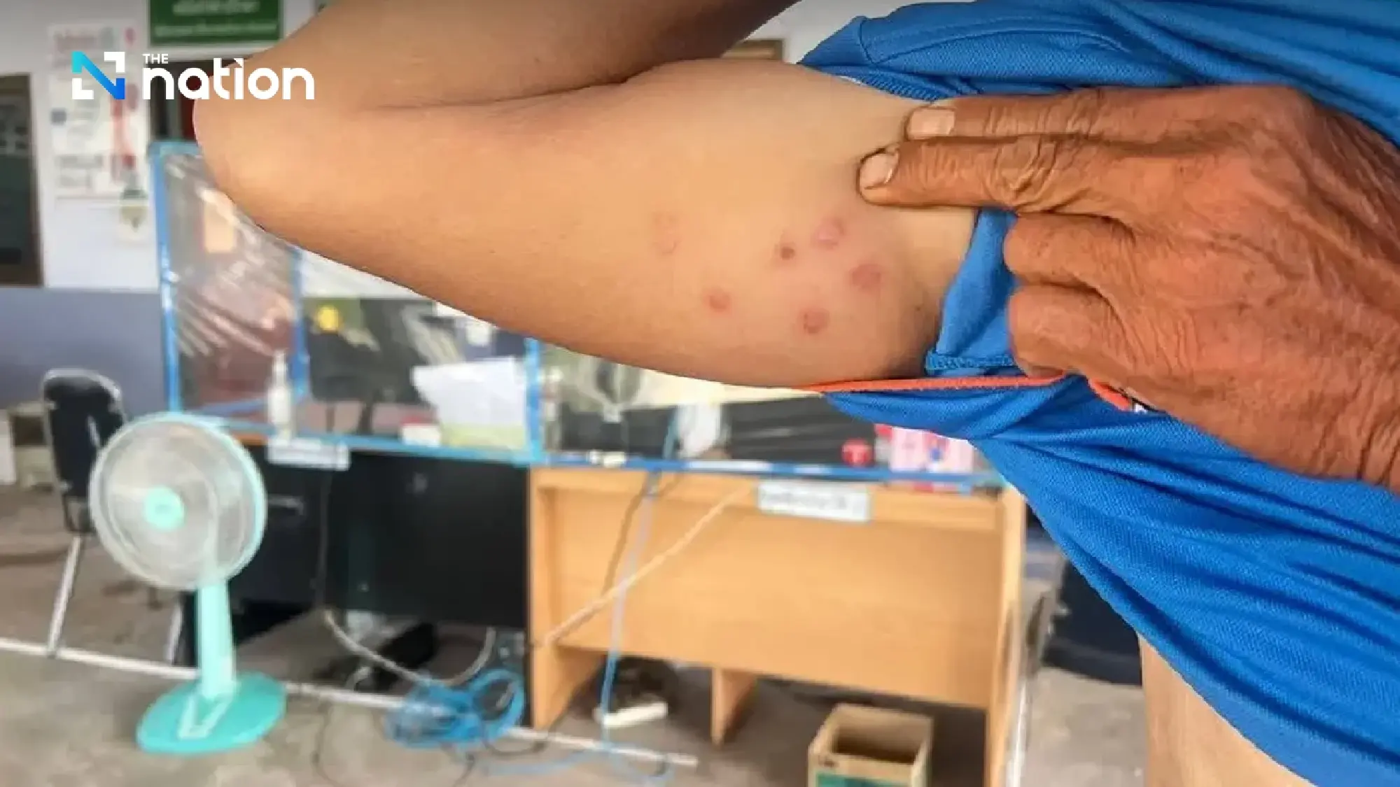 Anthrax suspected in Nong Bua Lamphu; Urgent contact tracing launched