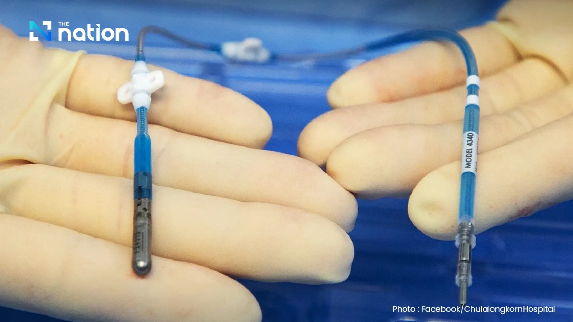 Chulalongkorn Hospital succeeds with first HGNS surgery in Thailand for sleep apnea