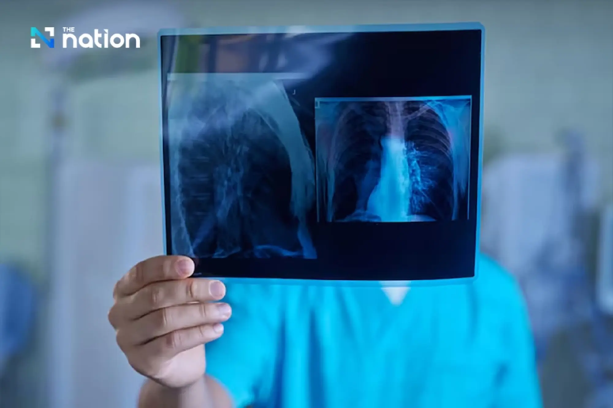 AI lung cancer screening: Health innovation for all