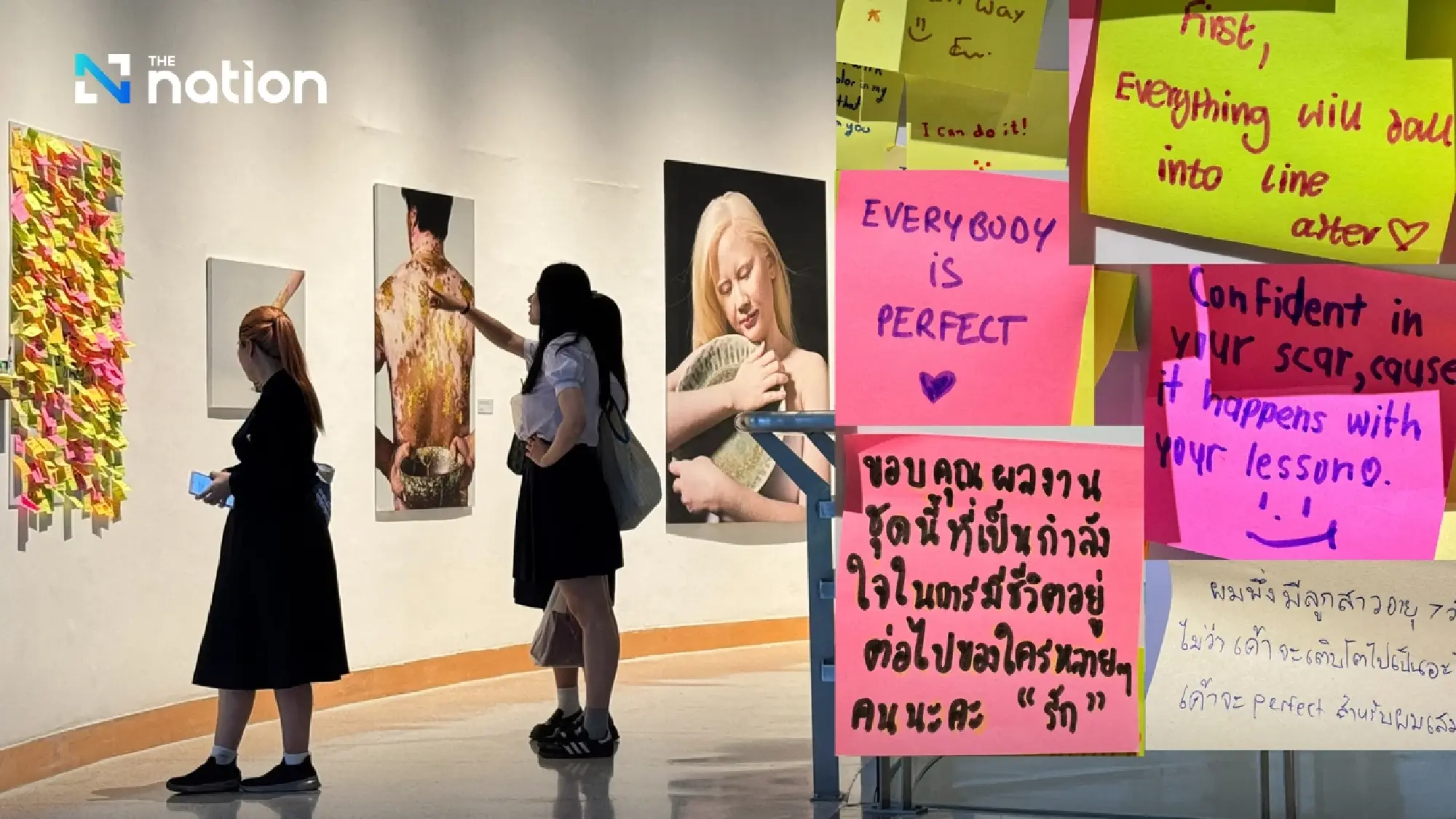 From scars to strength: a project inspiring self-acceptance and self-love