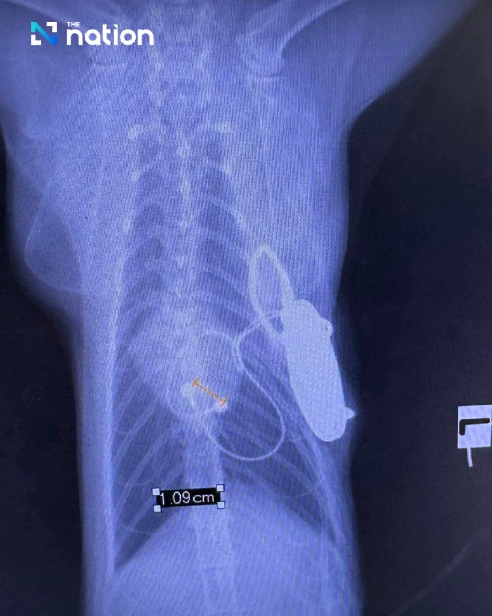 Thai Vets Perform Country's First Feline Pacemaker Implant in Landmark Cardiology Breakthrough