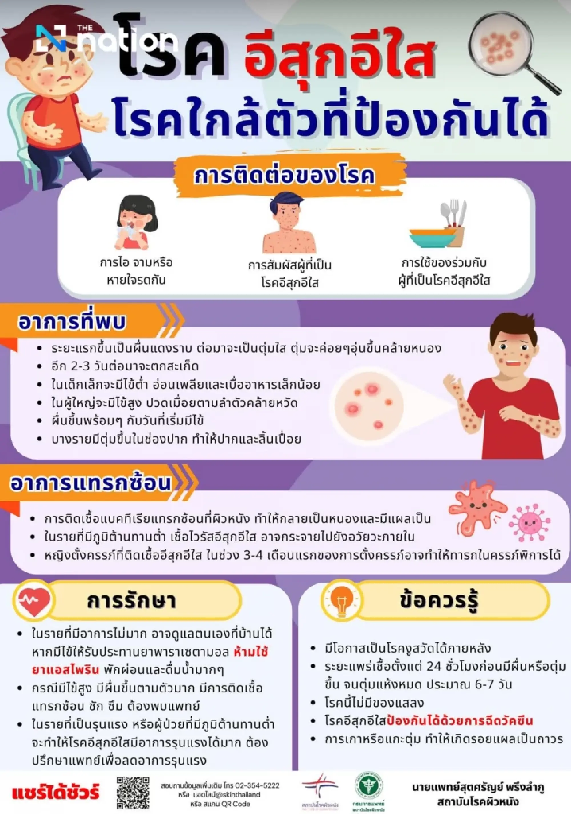 DDC probes chickenpox outbreak at Thammasat Rangsit campus