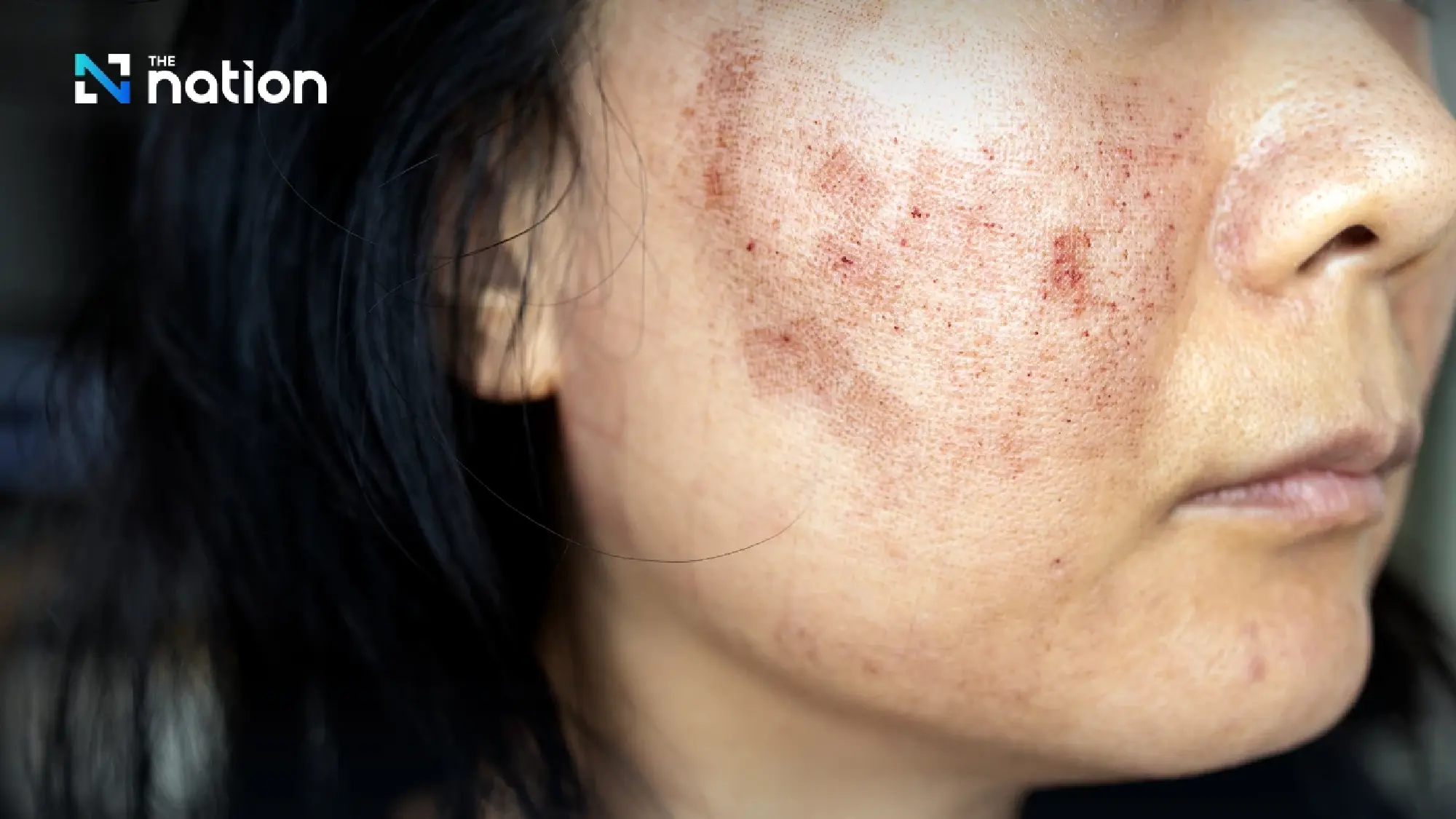 Thailand sees rising risks of summer illness in extreme heat