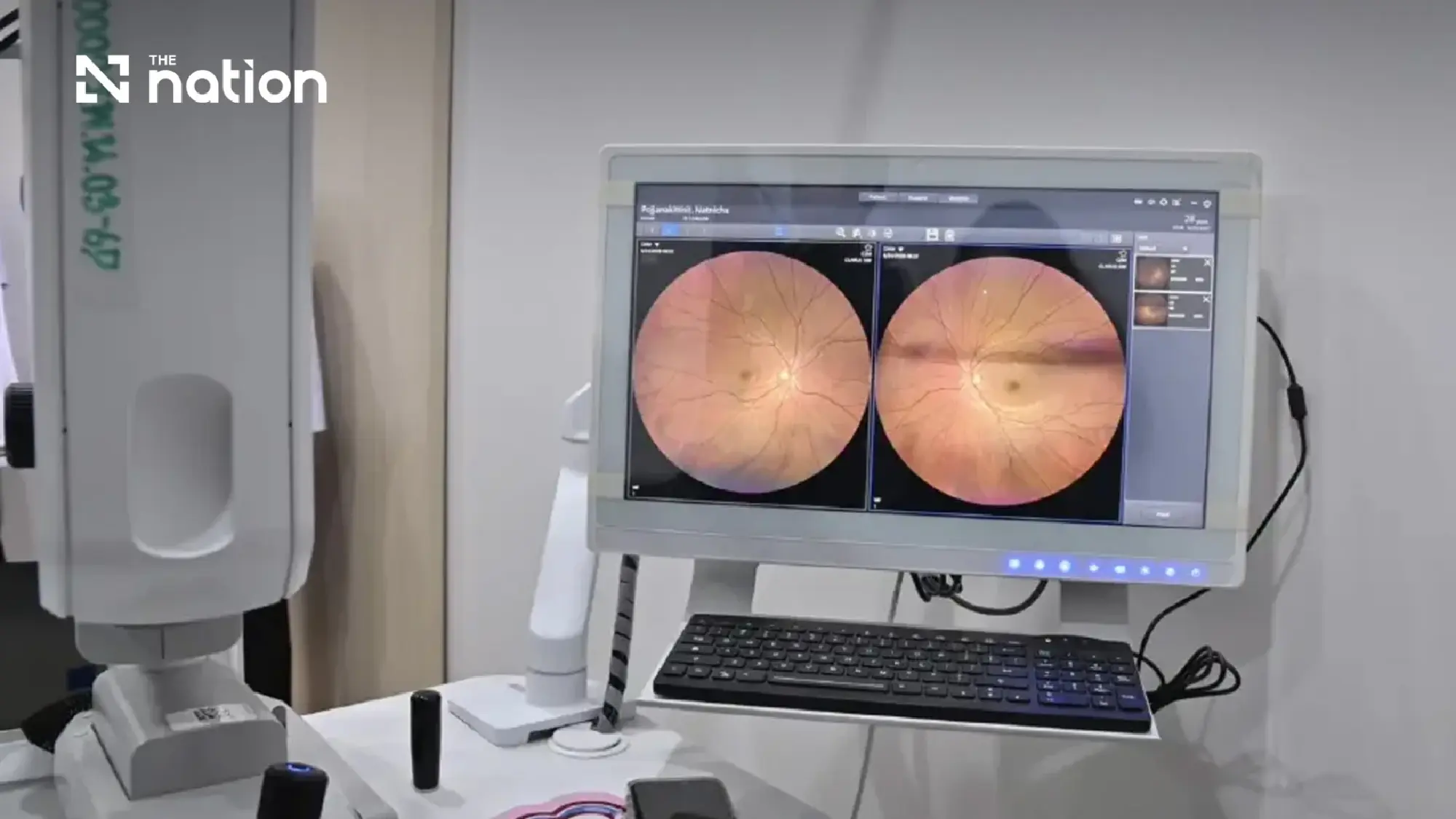Thai surgeon performs Thailand’s first interprovincial telesurgery on prostate cancer patient