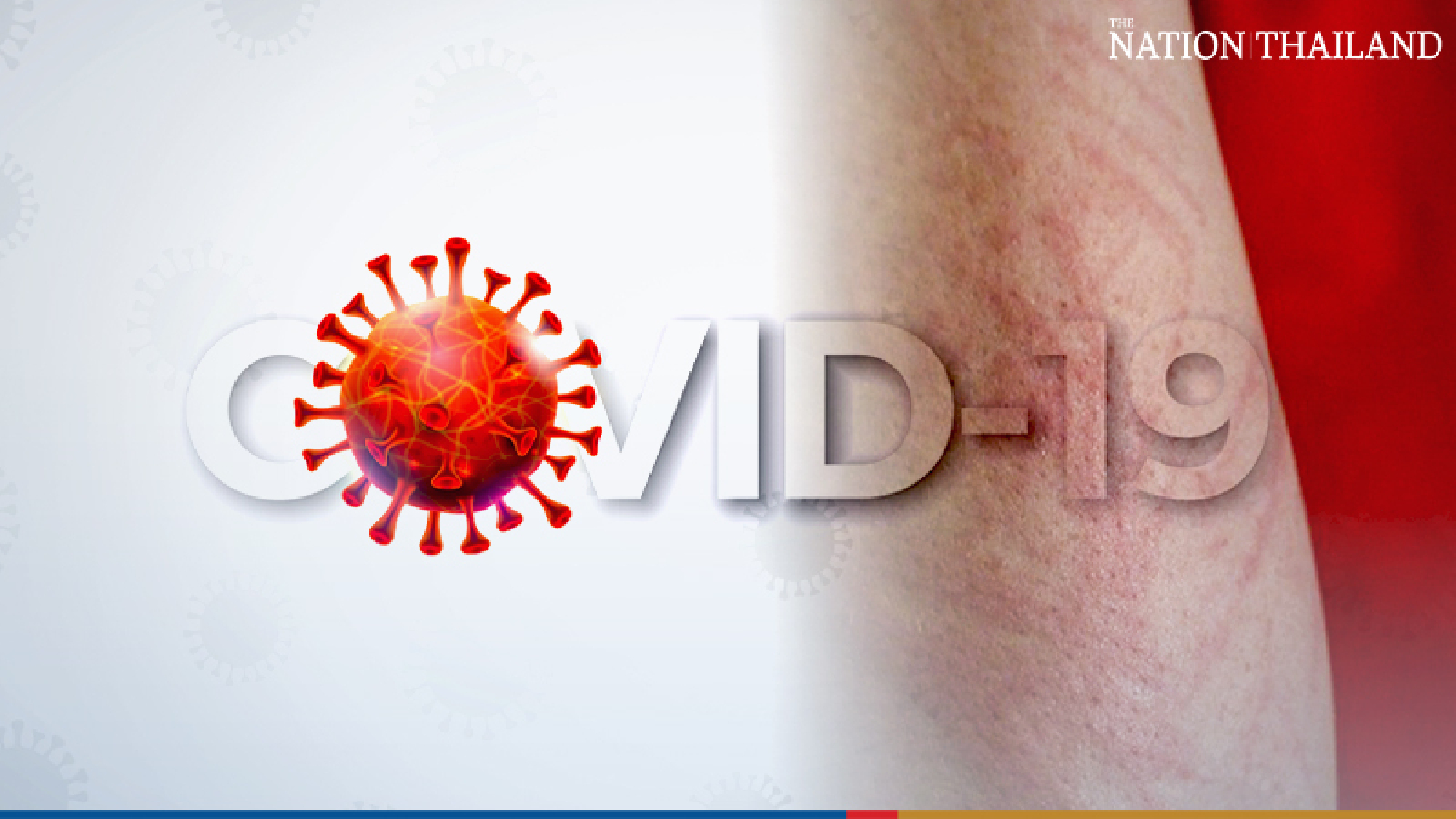 418 Covid-19 patients suffer from severe symptoms, over 100 on respirators