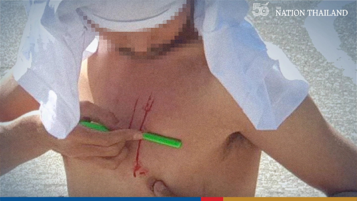 Charged Chiang Mai student cuts 112 on his chest with a razor Charged Chiang Mai student cuts 112 on his chest with a razor