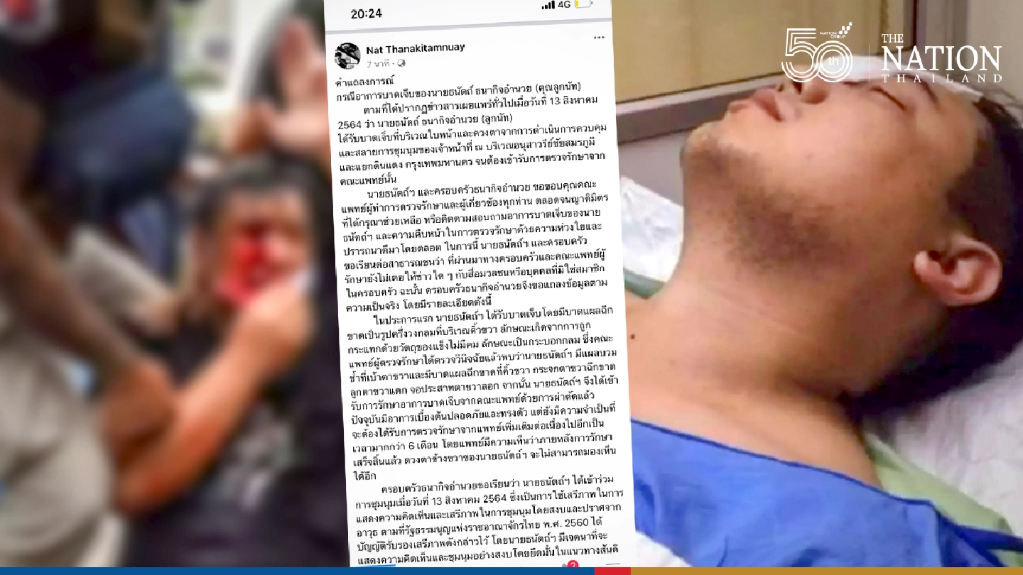 Family vows legal action after activist blinded in one eye by alleged police action
