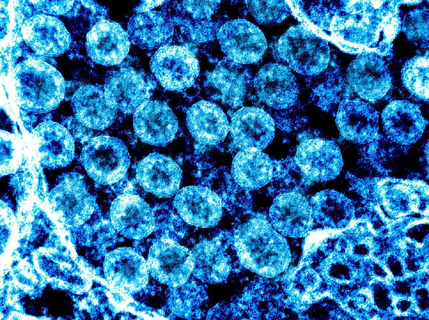 Politicizing virus-tracing jointly opposed