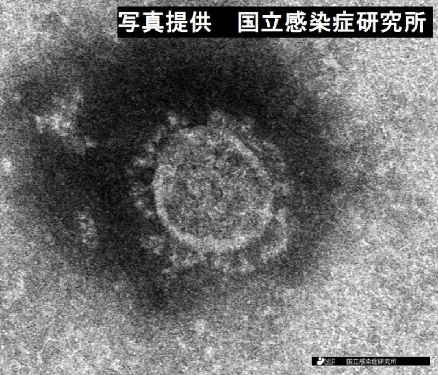 Japan tops 1 million cumulative virus cases Japan tops 1 million cumulative virus cases