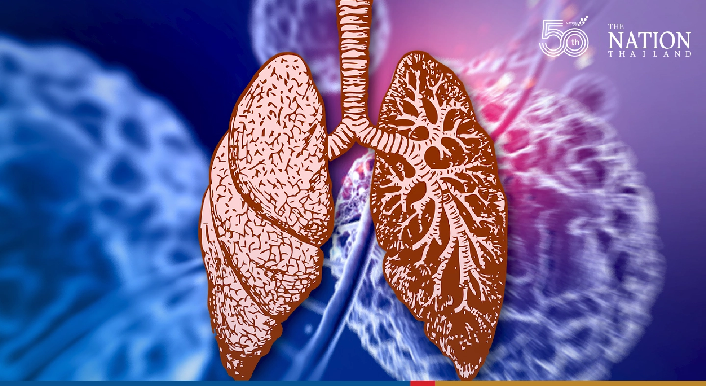 Global lung health meet opens with top three science announcements Global lung health meet opens with top three science announcements