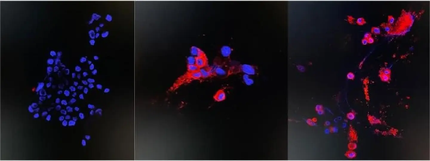 HKU research team successfully isolates Omicron variant HKU research team successfully isolates Omicron variant