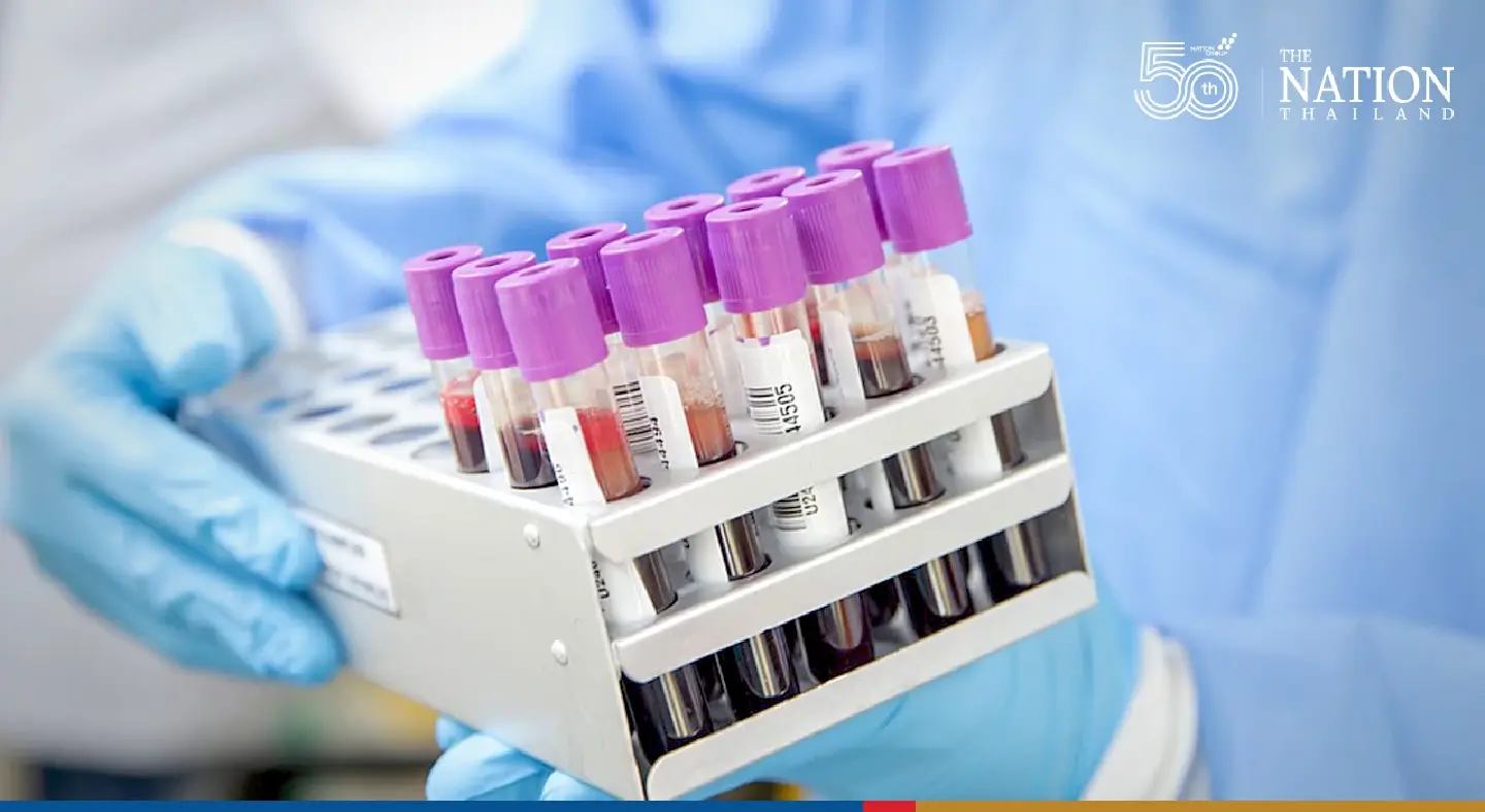 GPO expected to release new Aids drugs by 2022-end GPO expected to release new Aids drugs by 2022-end