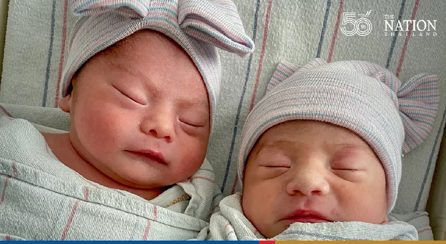 Twins born in US don’t share same birthday, month or even year Twins born in US don’t share same birthday, month or even year