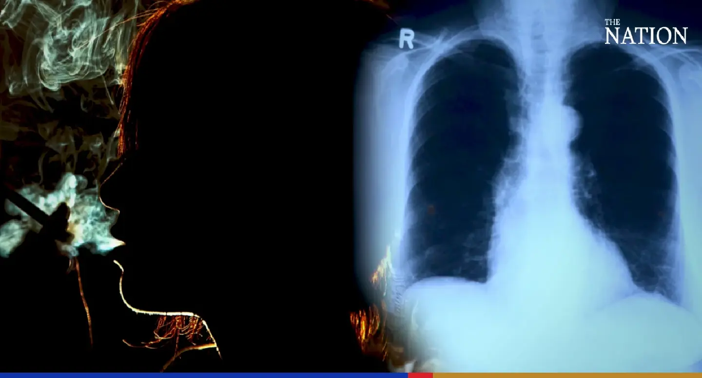 Lung cancer: How to avoid Thailand’s leading killer