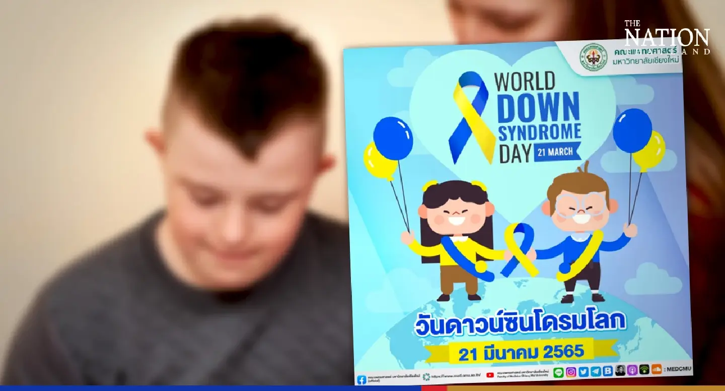 March 21: Day of inclusion, acceptance, awareness of Down syndrome