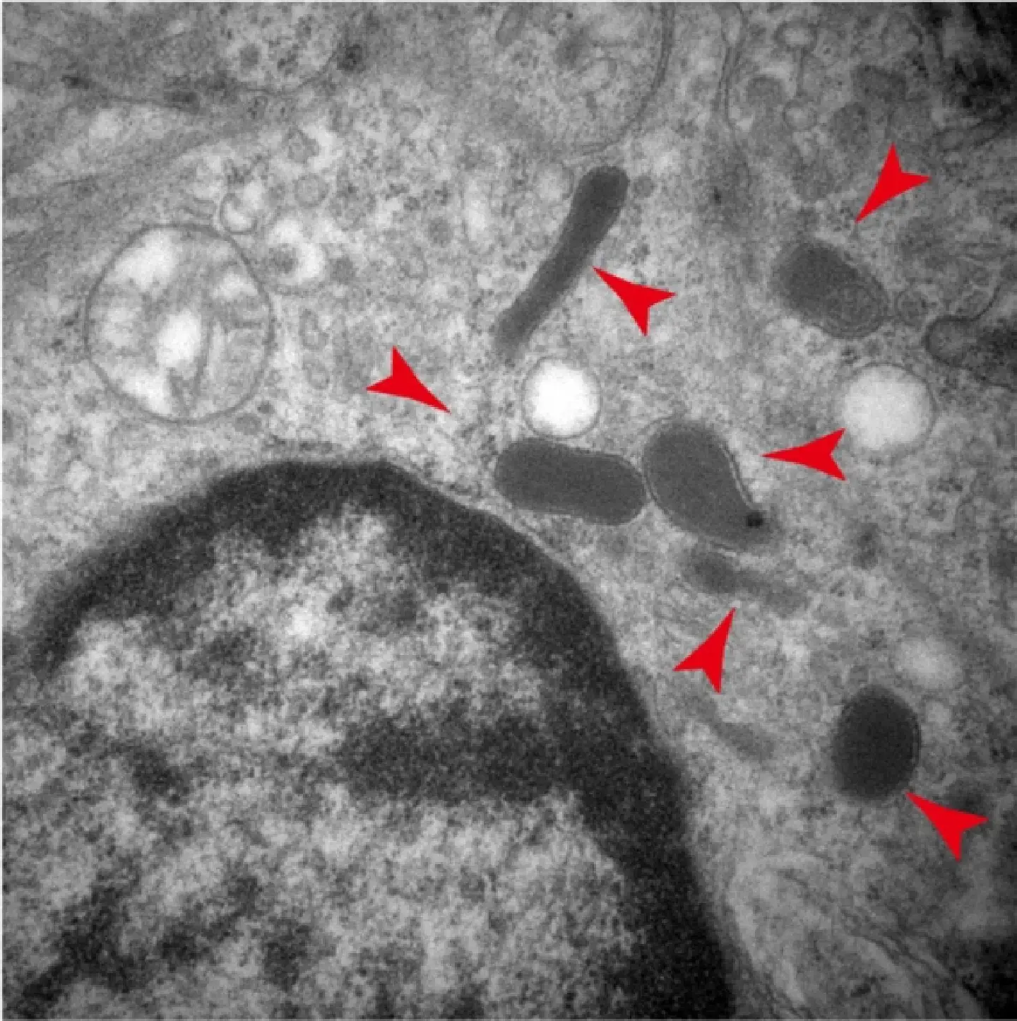 Bacteria in tumors help cancer cells metastasize: study Bacteria in tumors help cancer cells metastasize: study