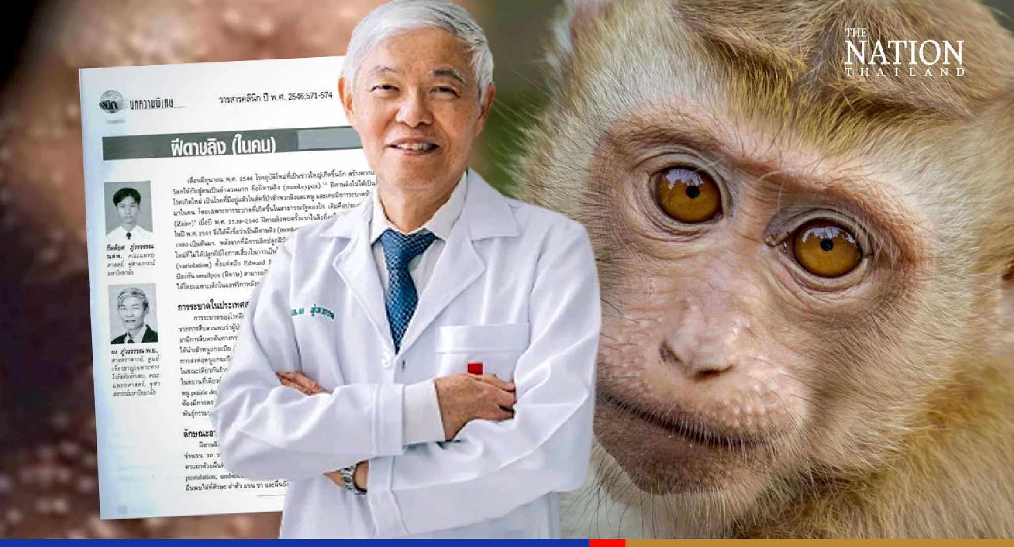 Chula virologist downplays concerns about monkeypox