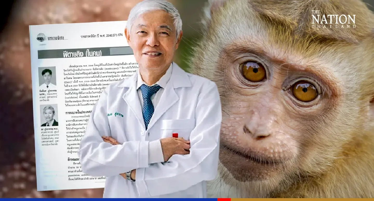 Chula virologist downplays concerns about monkeypox Chula virologist downplays concerns about monkeypox