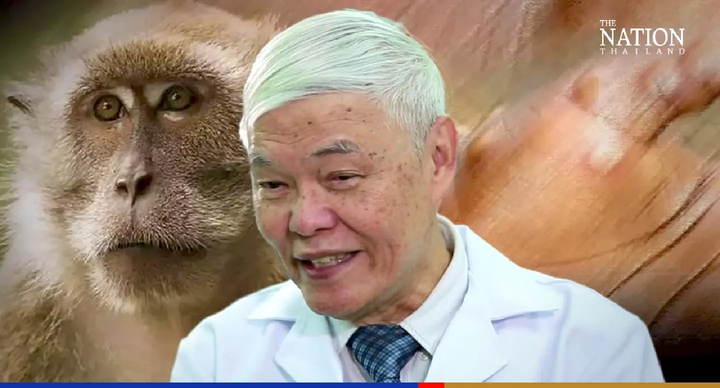 Mild symptoms will make monkeypox tough to contain: virologist