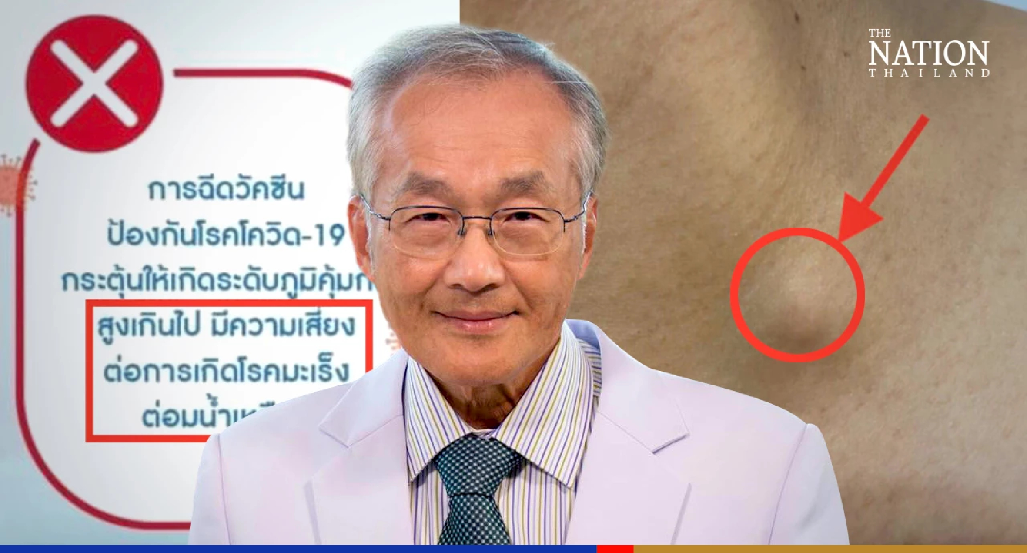 Medical expert rubbishes rumours of mRNA booster dose causing lymphoma