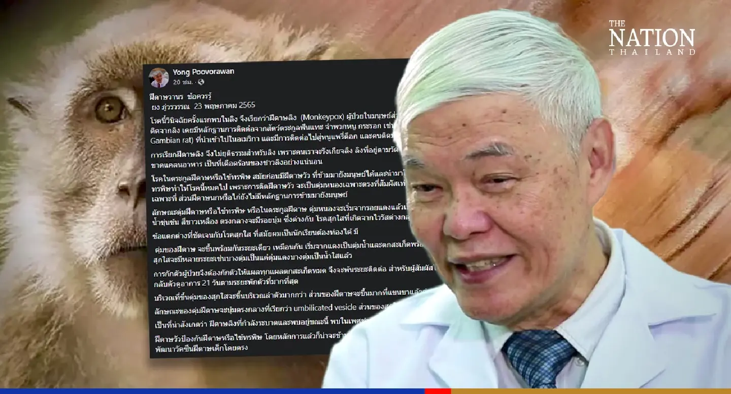 Thai virus expert sounds warning on spread of monkeypox Thai virus expert sounds warning on spread of monkeypox
