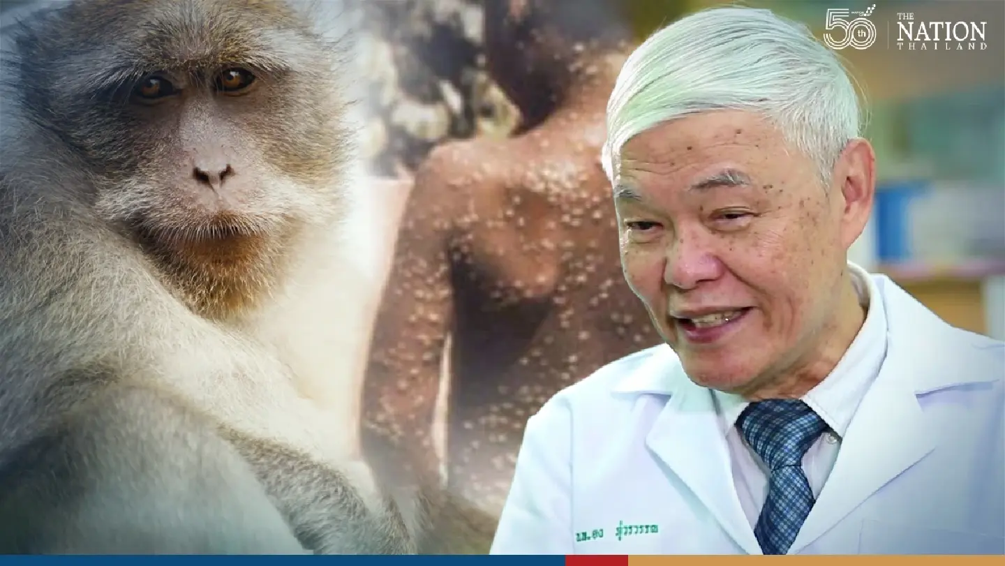 Low risk of monkeypox outbreak in Thailand, says top virologist Low risk of monkeypox outbreak in Thailand, says top virologist