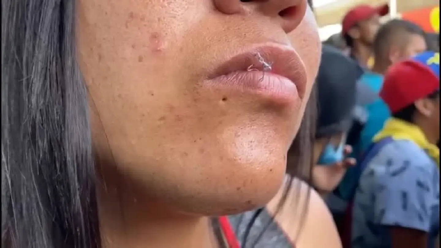 Migrants sew their mouths shut in protests to cross the Mexico-U.S. border