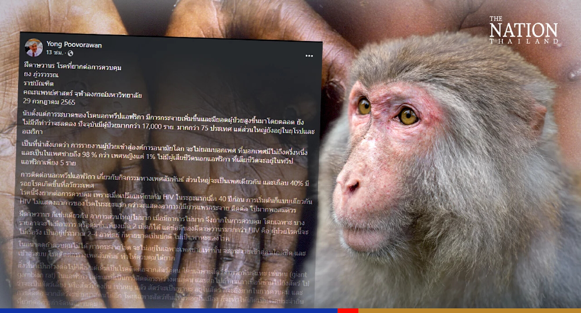 Virologist explains why it is tough to control spread of monkeypox