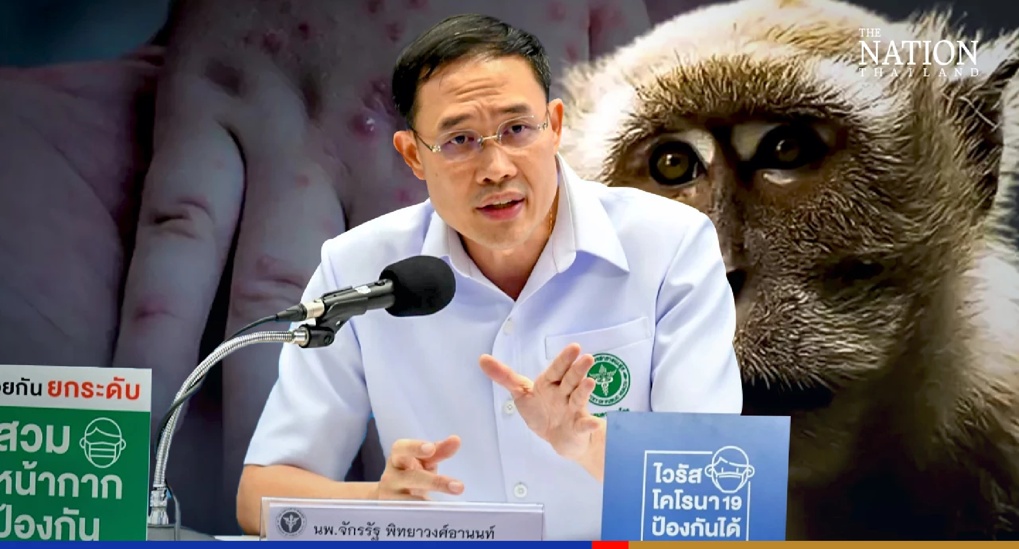 Monkeypox not in ‘dangerous’ category yet, says Public Health Ministry