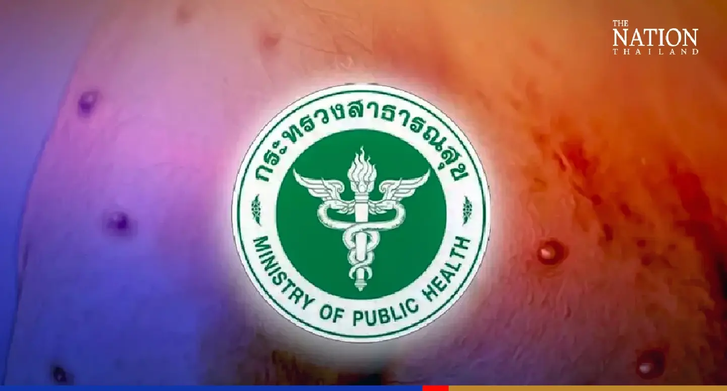 Officials looking for European man linked to 2nd monkeypox case