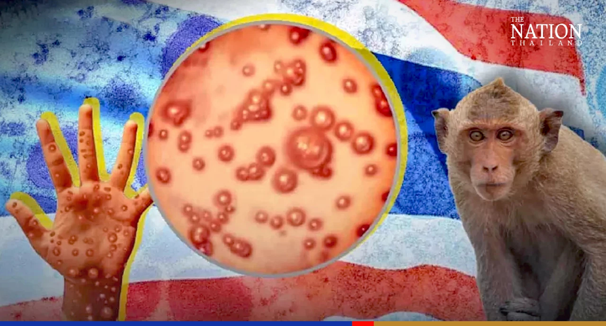 Thailand's second monkeypox case found in Bangkok