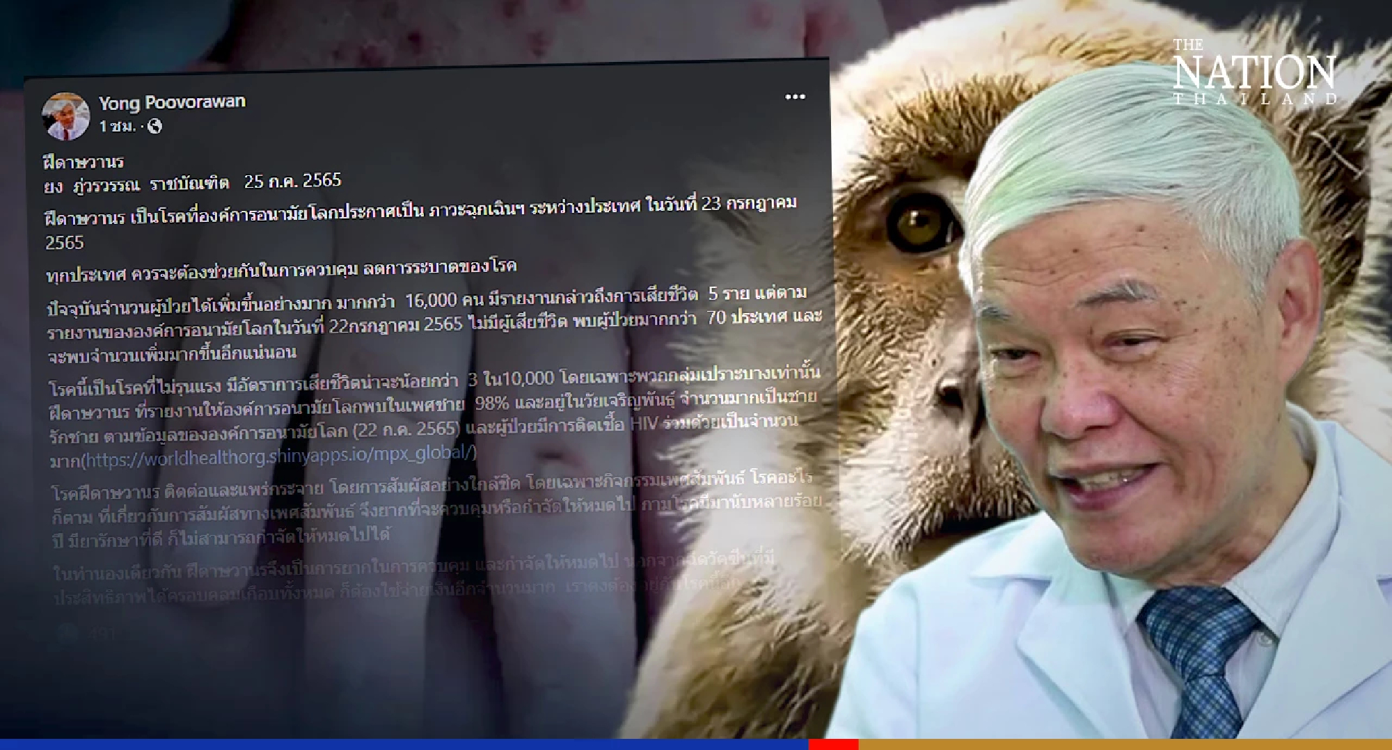 Monkeypox will soon be like other venereal diseases, says virologist
