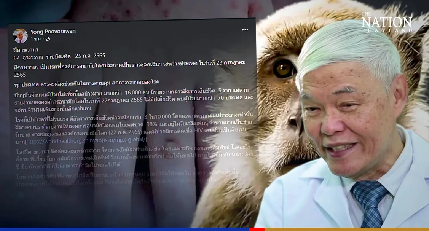 Monkeypox will soon be like other venereal diseases, says virologist