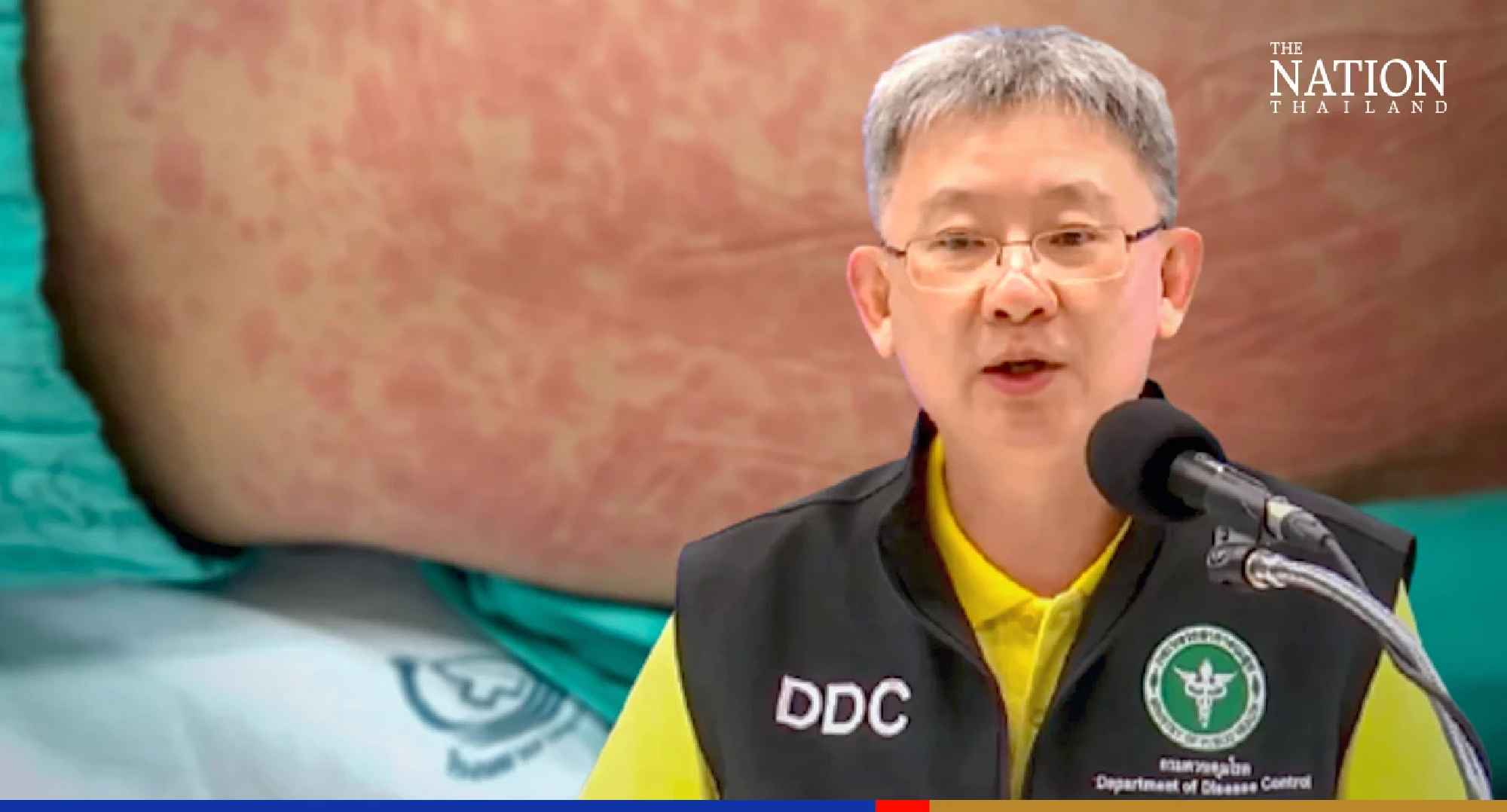 2nd grader dies of inflammatory syndrome, wasn’t vaccinated: DCD chief