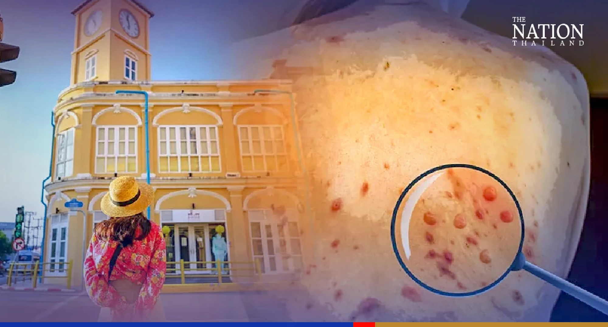 Thailand's first monkeypox case found in Phuket