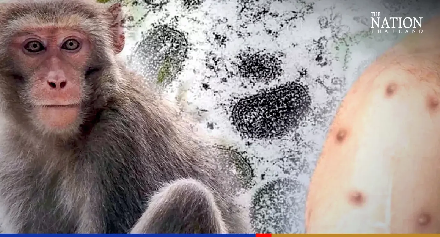 WHO seeks new name for monkeypox to prevent stigma, protect monkeys WHO seeks new name for monkeypox to prevent stigma, protect monkeys