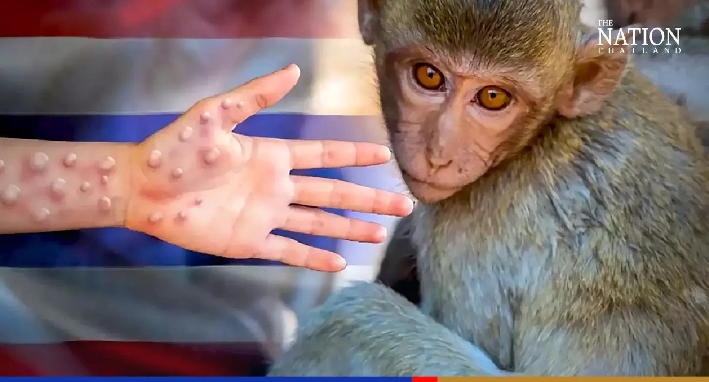 Most Thais fear monkeypox, fewer than half think govt in control: poll