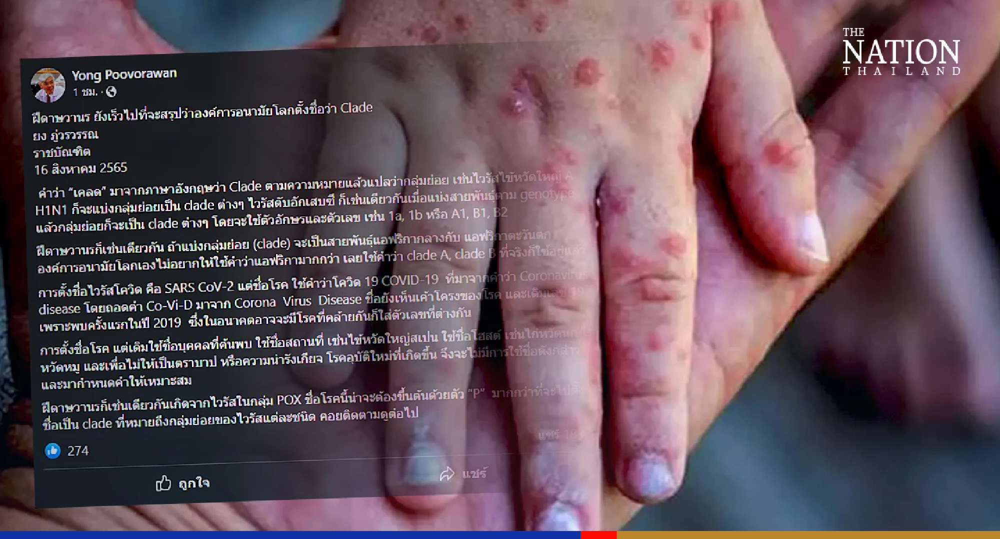 Tale of 2 clades: Virologist calls on WHO to rename monkeypox first